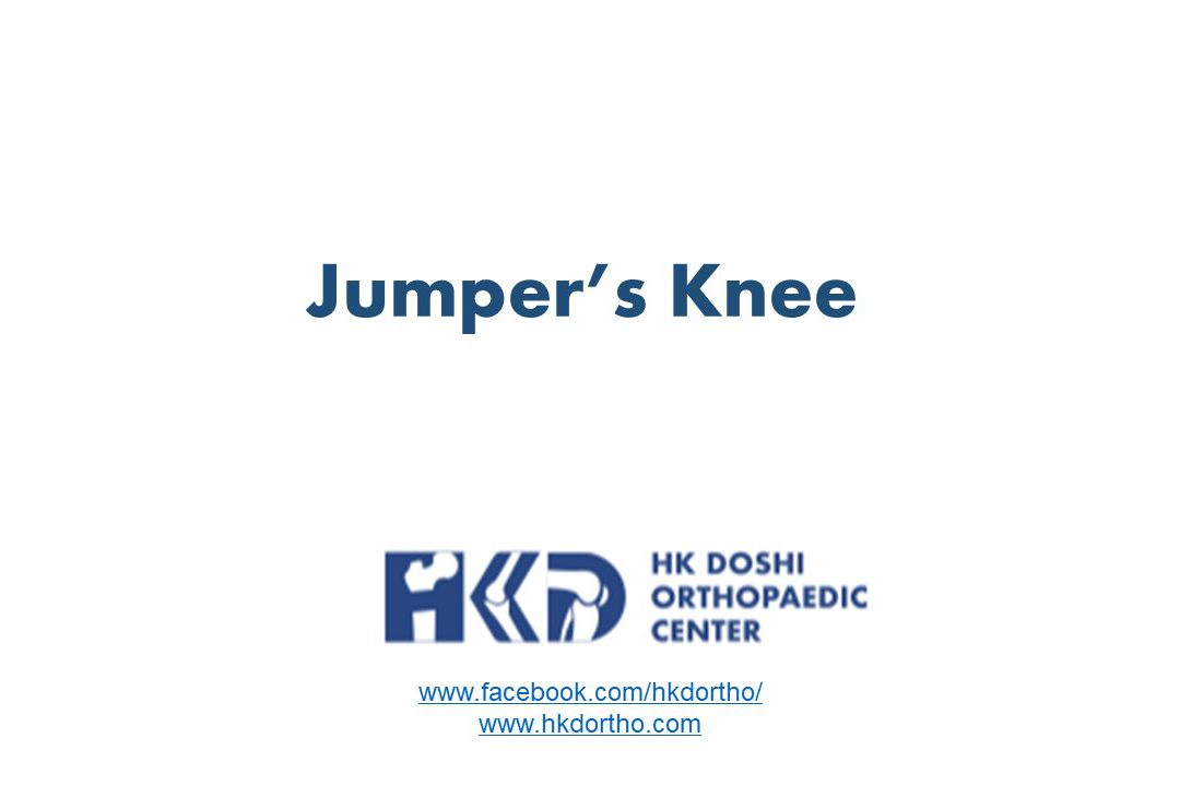 Jumper’s Knee